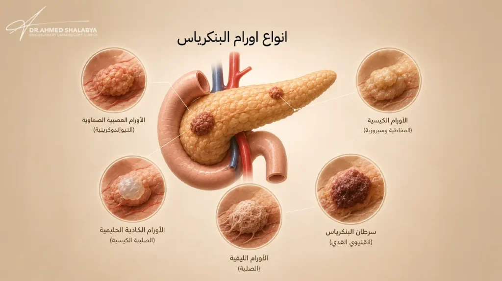 انواع اورام البنكرياس