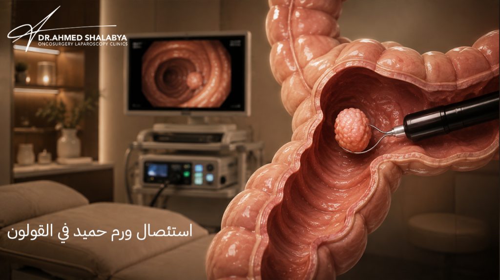 استئصال ورم حميد في القولون