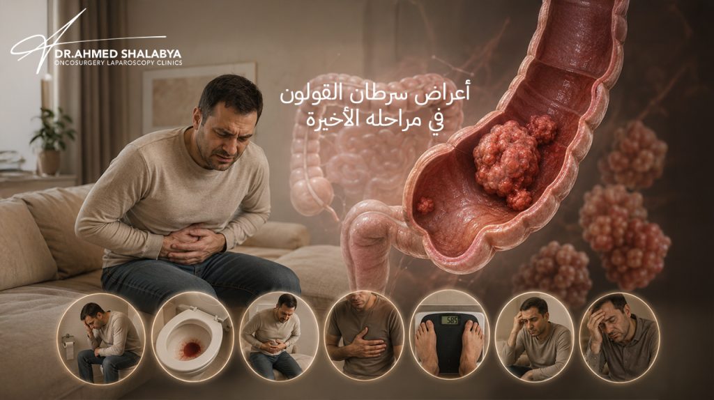 أعراض سرطان القولون في مراحله الأخيرة: